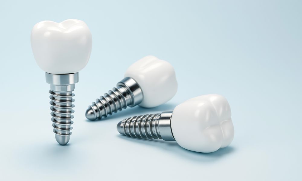 Titan-Zahnimplantate bei Procon Medizintechnik